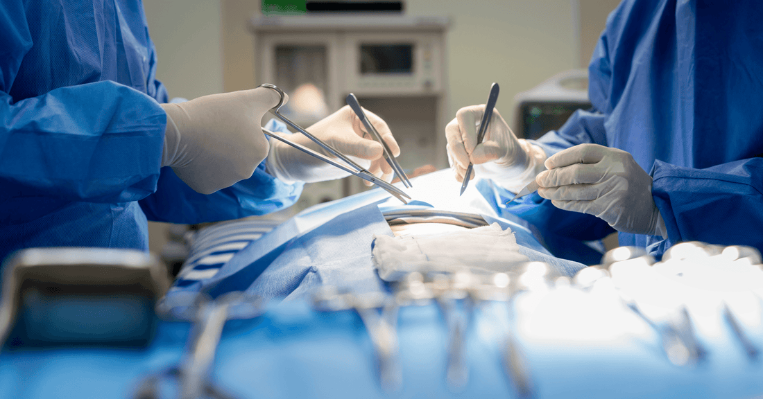 Understanding Tonsillectomy for Tonsil Stones